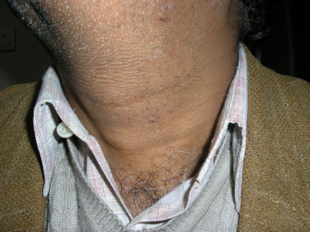 Dr Pandya Clinic Udaipur